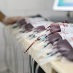 آیا در صورت حجامت می‌توانیم اهدای خون انجام دهیم؟